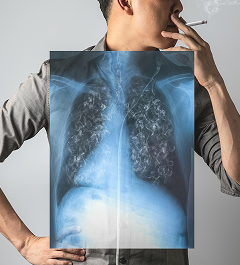 Smokers Basic package